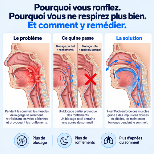 HushPod — Patch Anti-Ronflement à Impulsions.